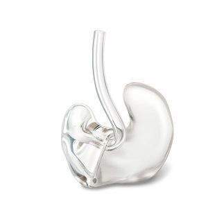 Индивидуальный ушной вкладыш Индивидуальный ушной вкладыш